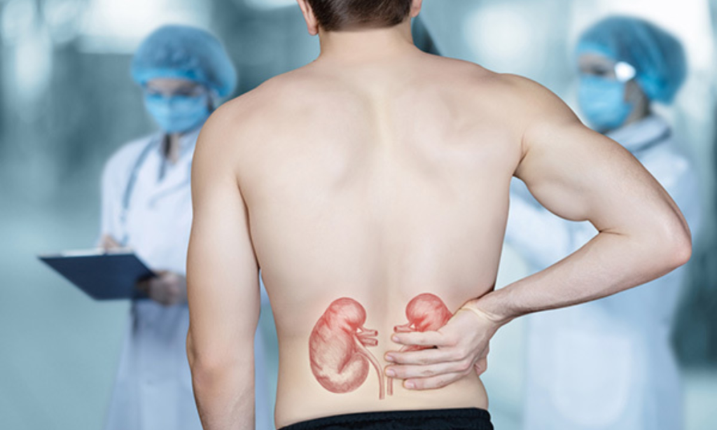 Fatores de Risco para Câncer Renal