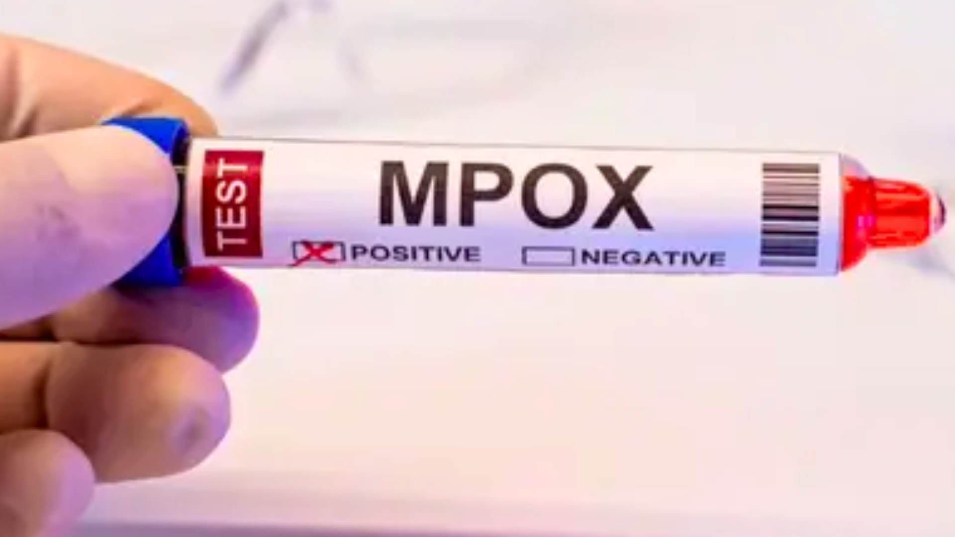 Brasil registra 88 casos